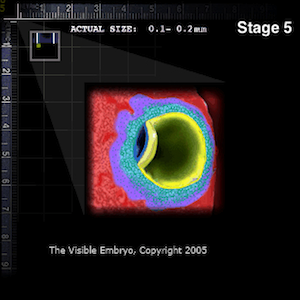 Implantation Complete